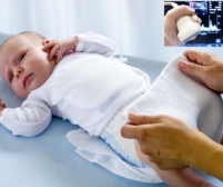 Badanie USG bioderek niemowląt